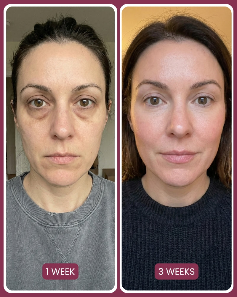 Medicube PDRN Pink Collagen Volume Multi Balm